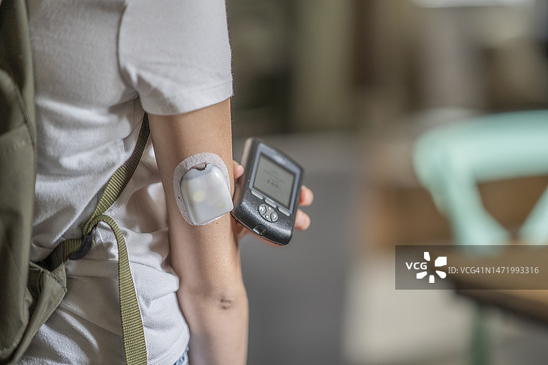 糖尿病扫描图片素材