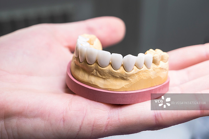 手中的牙科陶瓷牙齿模型特写图片素材