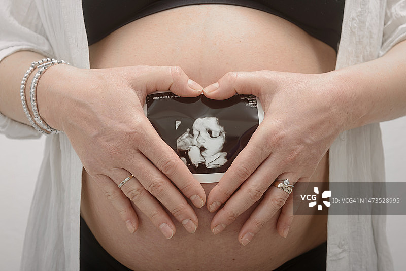 女士手持腹部B超单图片素材