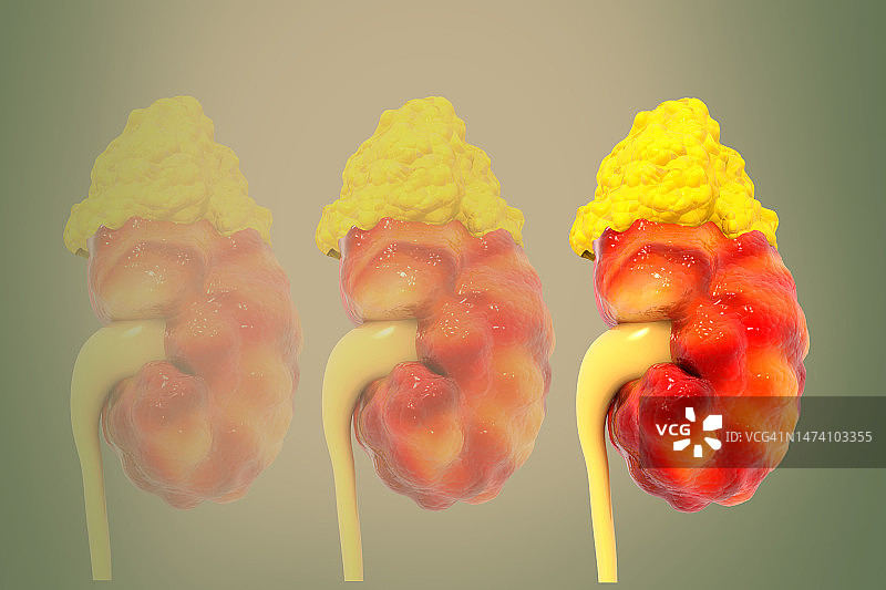 医疗背景上的人体肾脏3D图图片素材