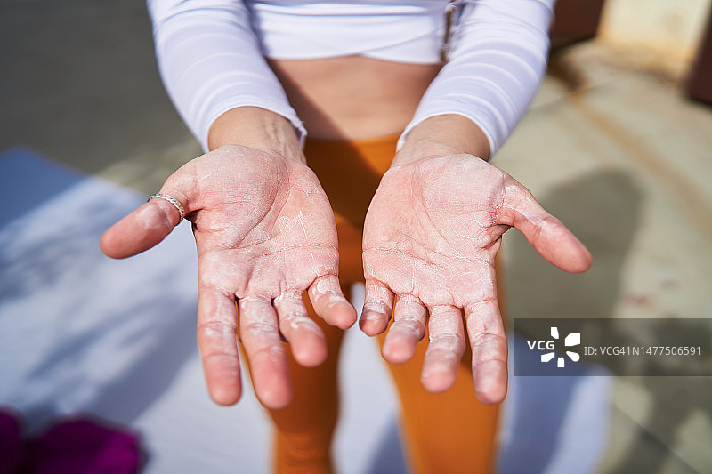 练习绸吊特技后伤痕累累的双手图片素材