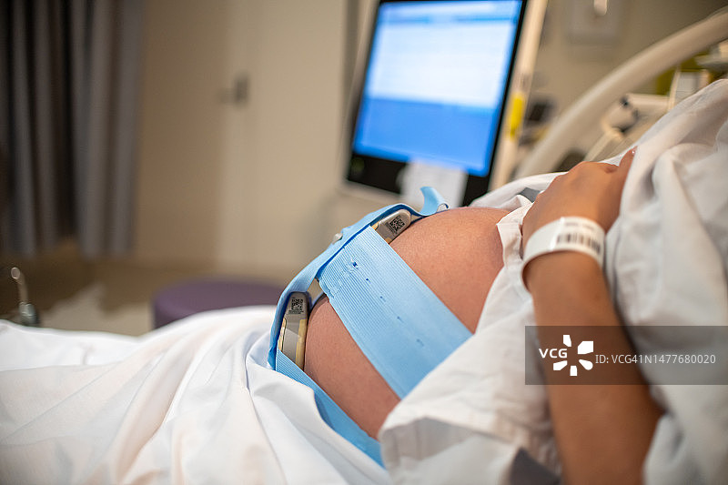 分娩早期胎心率监测图片素材