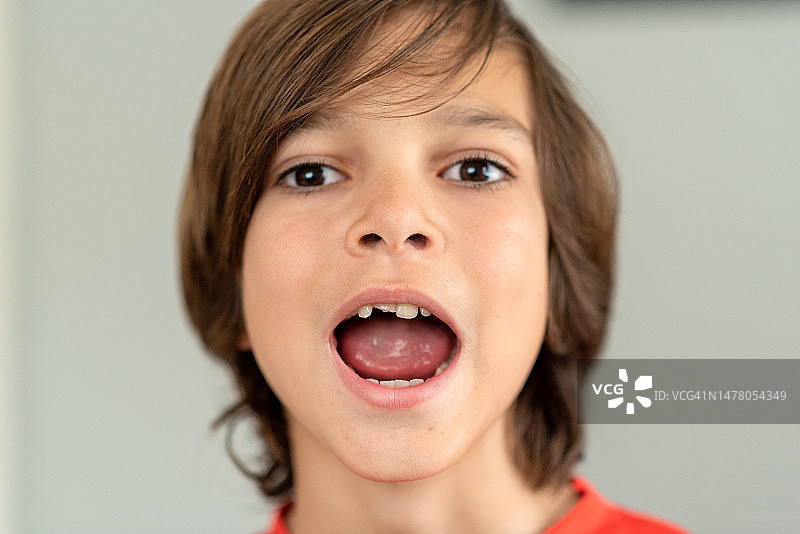 掉了一颗门牙的男孩肖像图片素材