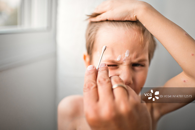 父亲在家给小儿子涂抹治疗水痘的药图片素材