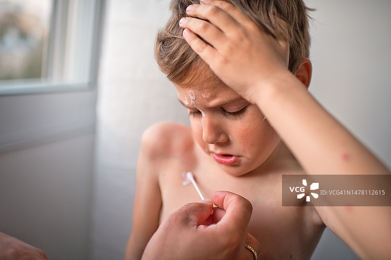 父亲在家给小儿子涂抹治疗水痘的药图片素材