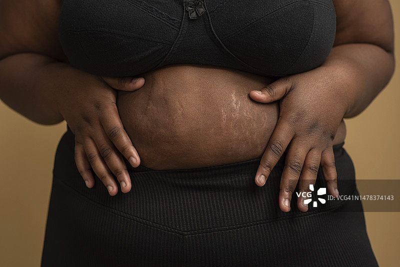 大码女性触摸有妊娠纹的腹部图片素材