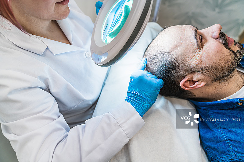 治疗脱发的女医生专家正在检查脱发患者图片素材