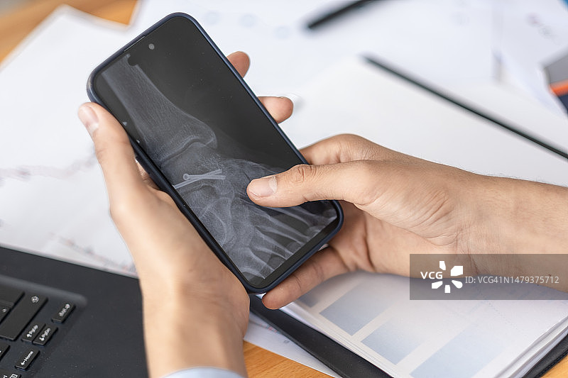 男人看手机X光片特写图片素材