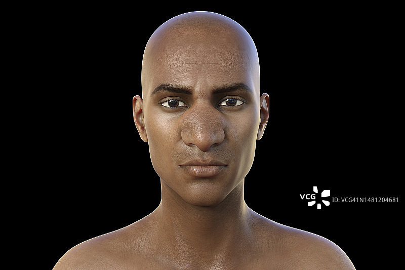 鼻面结合孢子菌病插图图片素材