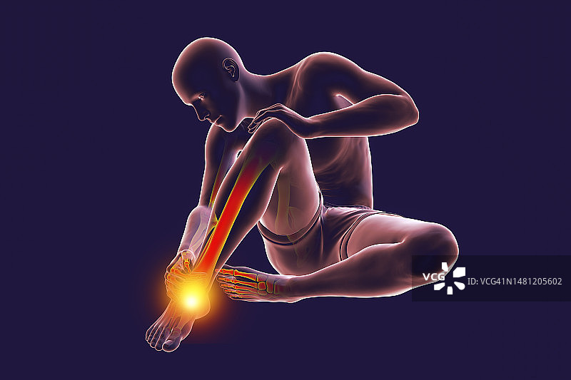 脚踝疼痛插图图片素材