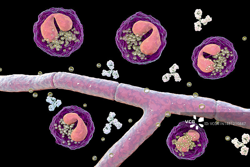 斯普伦多雷-赫普利现象插图图片素材