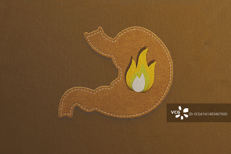 胃灼热，胃食管反流图片素材