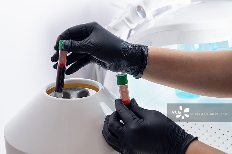 女美容师或医务人员将装有血液的试管放入离心机中分离血浆。美容医学与美容学概念，血浆提升与血浆疗法，以及自体血浆疗法图片素材
