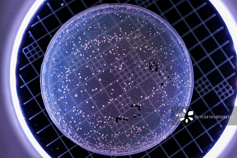 手持培养皿，内有细菌培养物图片素材