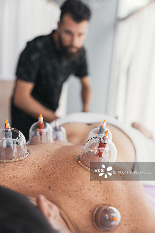 竖版照片：男子正在接受拔罐疗法图片素材