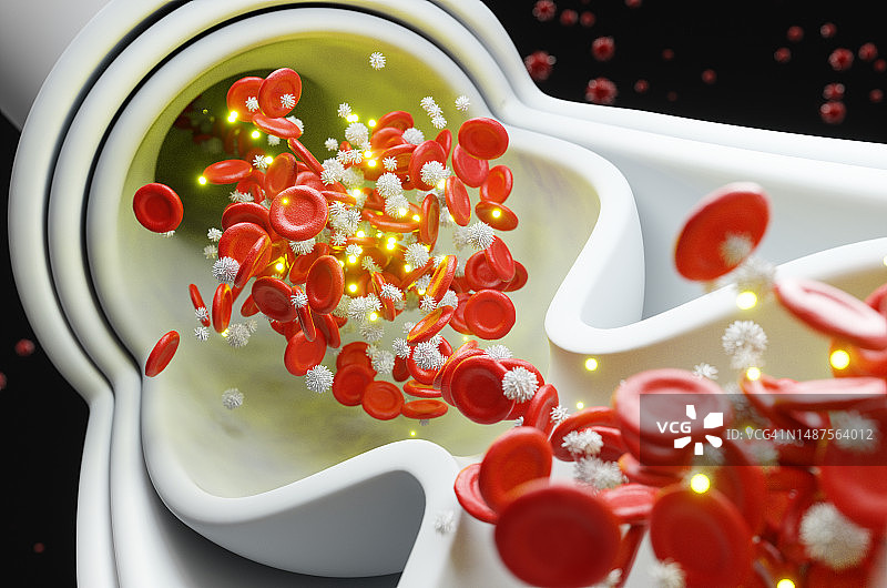 静脉曲张特写：静脉内部截面图片素材