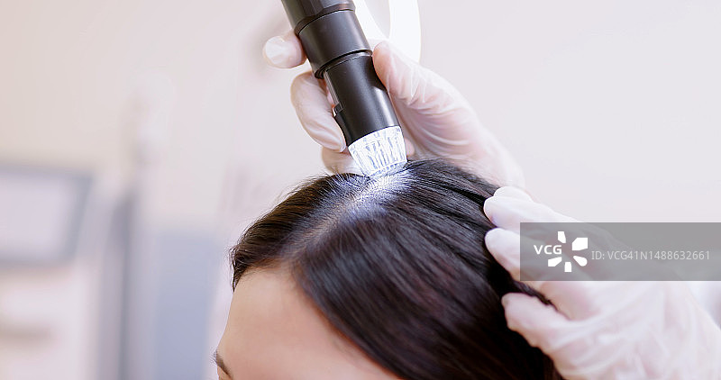 医生显微镜检查头皮图片素材