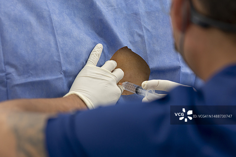 硬膜外麻醉：麻醉师为患者进行硬膜外麻醉图片素材