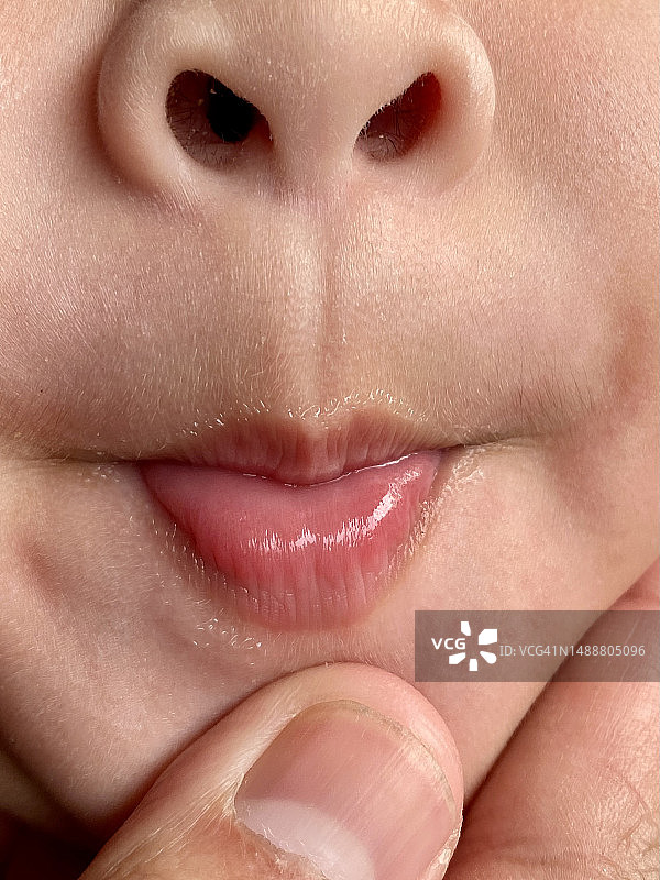 小女孩口腔检查特写图片素材