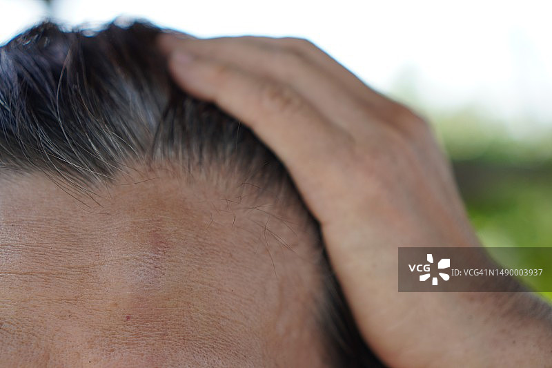 头部受伤的女人图片素材