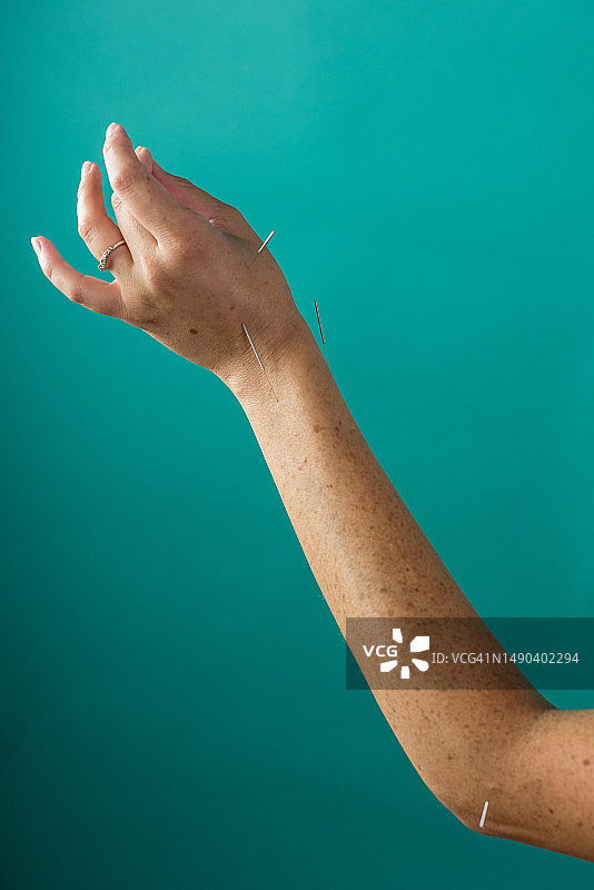 手部针灸图片素材