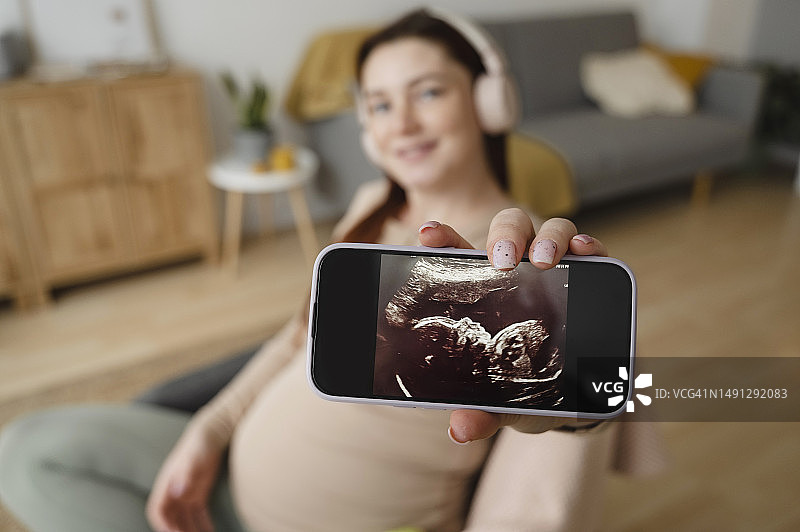 孕妇在智能手机屏幕上展示超声图像图片素材