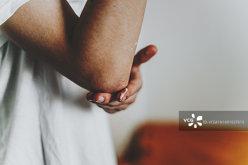 干燥的手肘皮肤图片素材