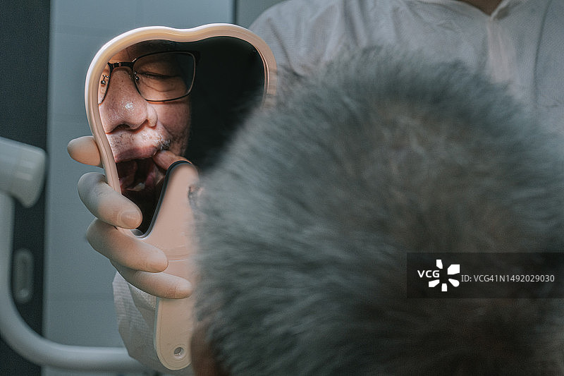 中国老年男性在牙科诊所将牙科假牙放入嘴里图片素材