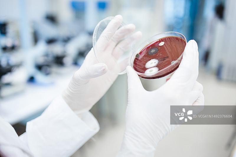 实验员观察真菌污染的培养皿图片素材