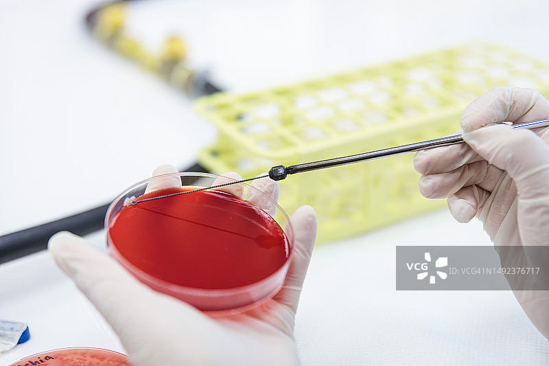 医学技术员在实验室用接种环将细菌菌落样本接种到麦康凯琼脂培养皿上图片素材