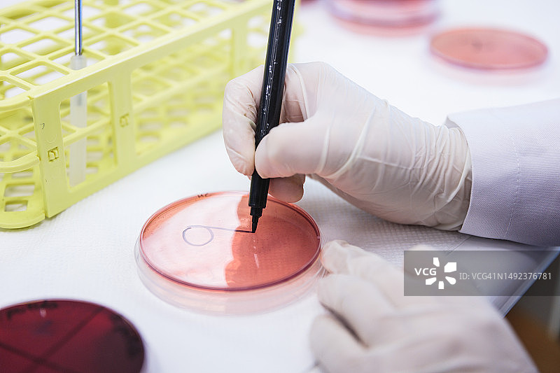 医学技术员在临床微生物实验室用记号笔标记带有血琼脂培养基的培养皿（无法辨认）图片素材