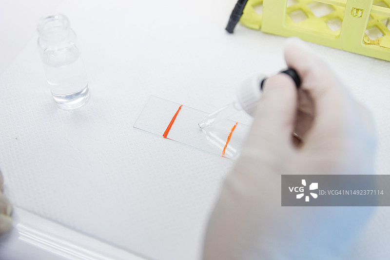 实验室专业技能：年轻女医务技术员在显微镜载玻片上持有革兰氏染色样品图片素材