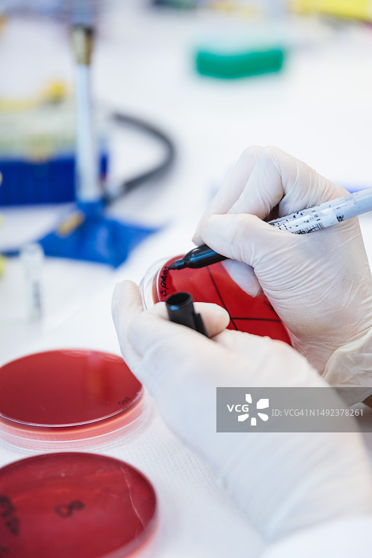 医学技术员在临床微生物实验室用记号笔标记带有血琼脂培养基的培养皿（无法辨认）图片素材