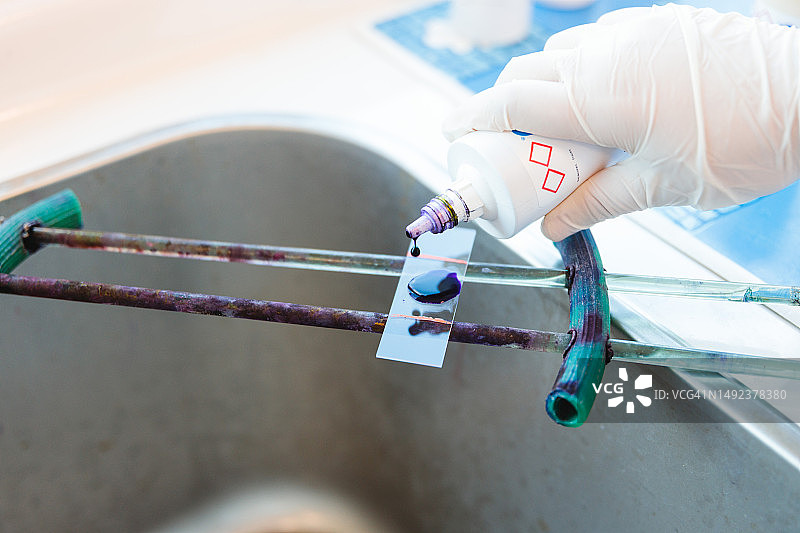 实验室专业技能：年轻女医务技术员在显微镜载玻片上持有革兰氏染色样品图片素材