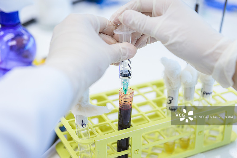 医学技术人员在实验室用注射器抽取试管中的血液样本图片素材