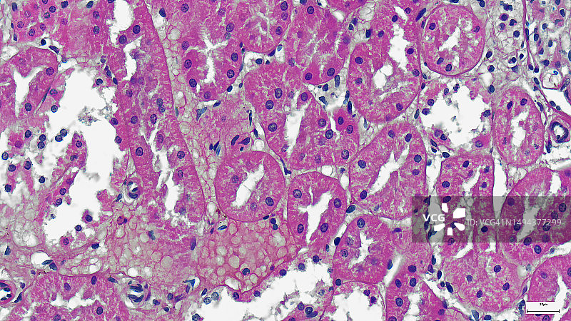 专业制备的显示乳腺组织的载玻片的显微照片图片素材