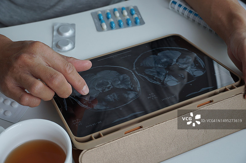 亚洲男人通过平板电脑查看脑部MRI扫描，了解脑肿瘤的阶段图片素材
