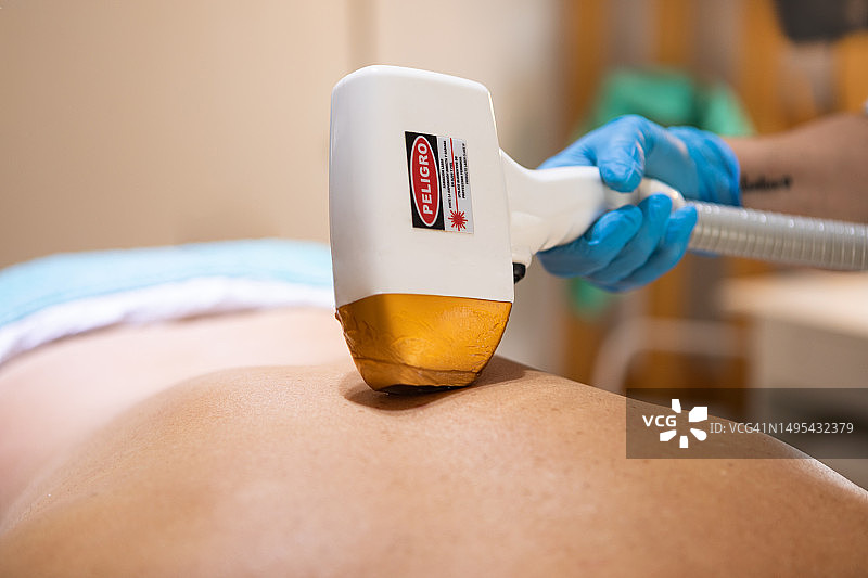 成年男人接受激光脱毛图片素材