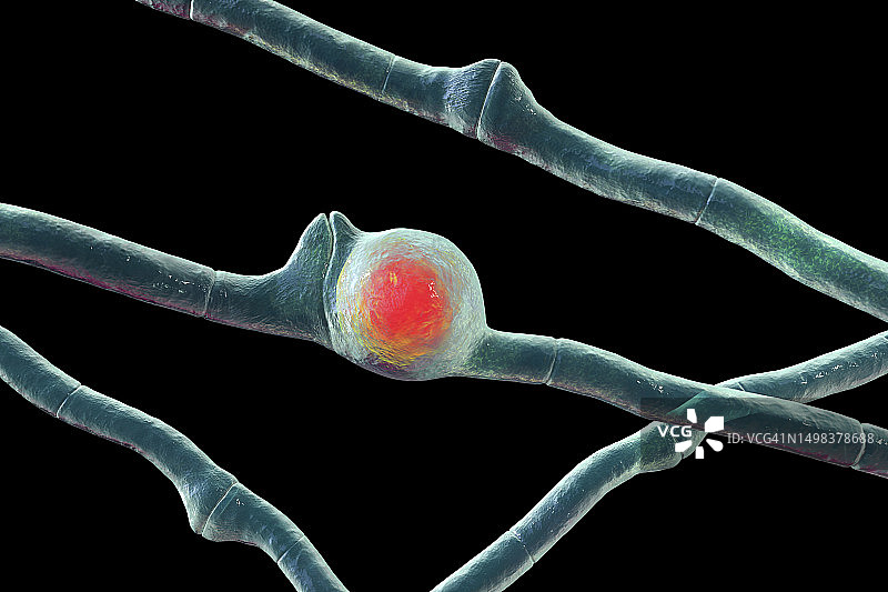 蛙粪掷孢霉菌插图图片素材