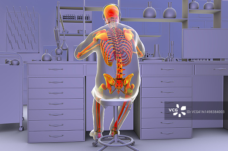 实验室工作人员的肌肉骨骼疾病插图图片素材
