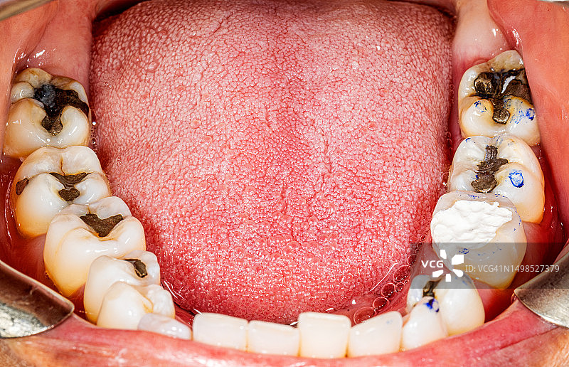 人手特写图片素材