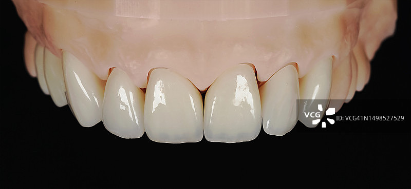 黑色背景下的假牙特写图片素材