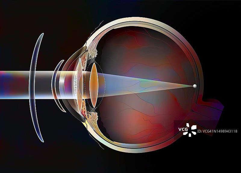 老花眼治疗图图片素材