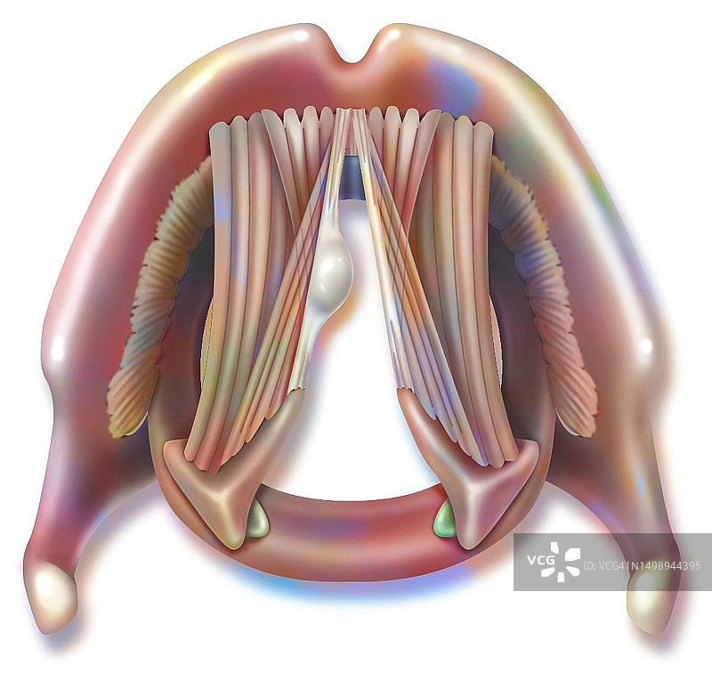 声带息肉图图片素材