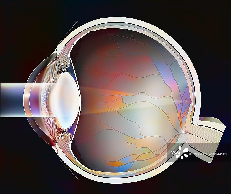 白内障绘画图片素材