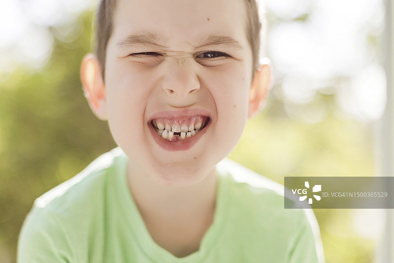 露出缺牙的可爱男孩图片素材
