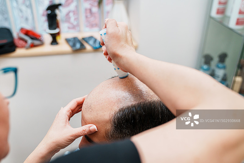 理发师：在头发诊所将假发粘在脱发患者的头上图片素材