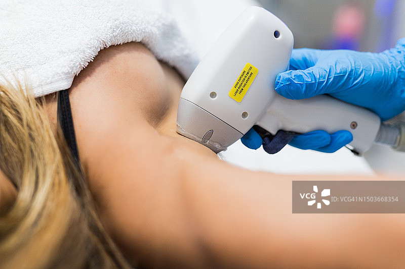 腋下激光脱毛过程图片素材