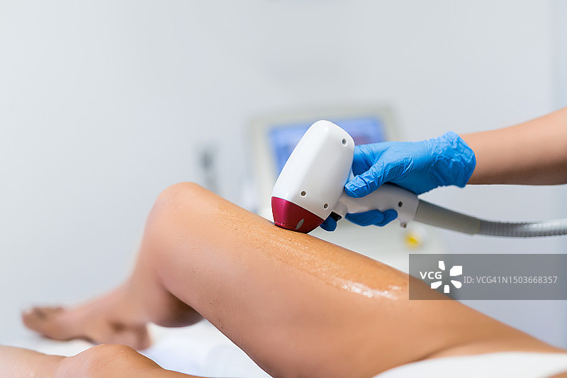 腿部激光脱毛过程图片素材