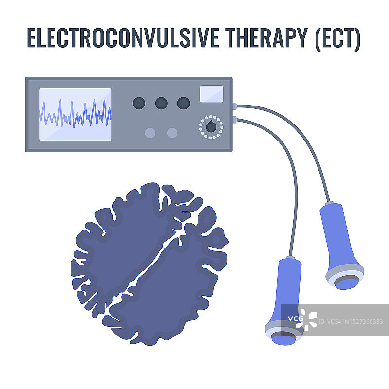 电休克疗法，插图图片素材